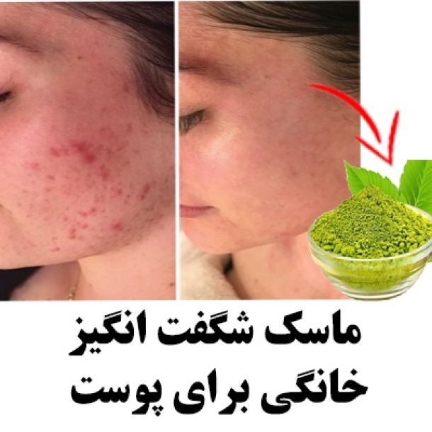 ماسک خانگی عالی برای همه مشکلات پوستی